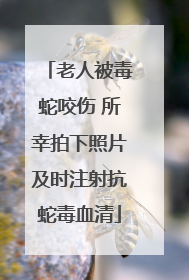 老人被毒蛇咬伤 所幸拍下照片及时注射抗蛇毒血清